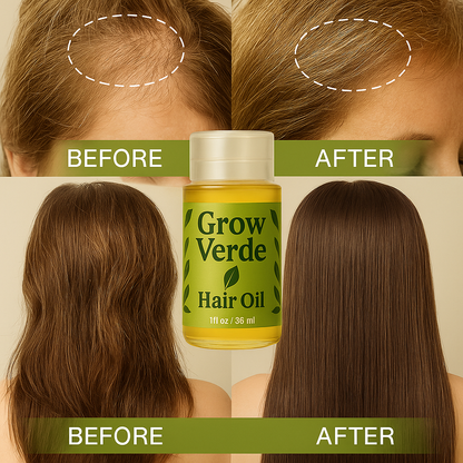 GrowVerde Revitalizing Organic Hair Oil™